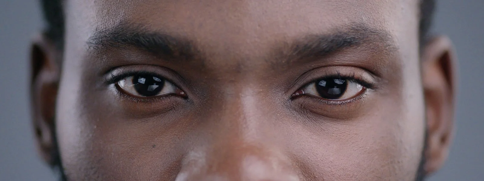 Close up of african americans eyes with an eyelid growth on one eye